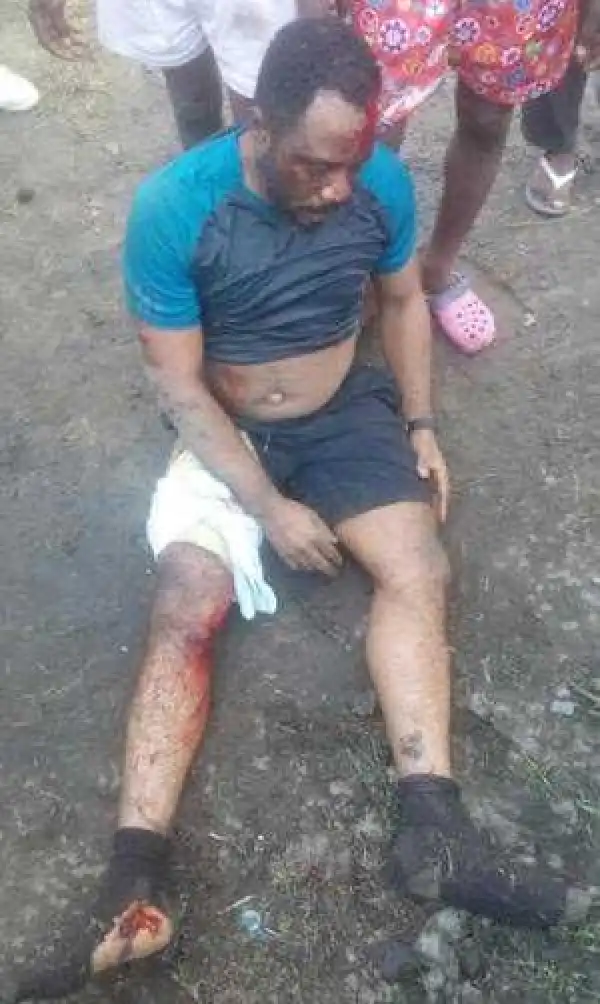 Medical Doctor Knocked Down While Jogging In Lagos (Photo)